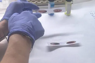 Alumnes de BAT 1 de Jesuïtes Lleida de l'assignatura de Biomedicina visitant el Banc de Sant i el Departament d'Anatomia Patològica de l'Hospital Universitari Arnau de Vilanova de Lleida